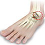 Arthritis - Foot & Ankle