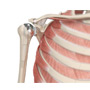 Shoulder Joint Replacement