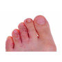 Athlete's Foot