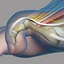 Common Toe Deformities